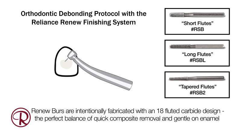 Debonding with the Renew Finishing System