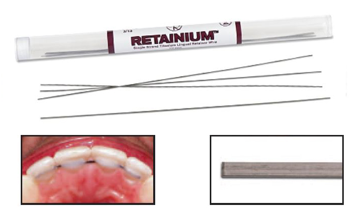 Maxillary Retention Using Retainium